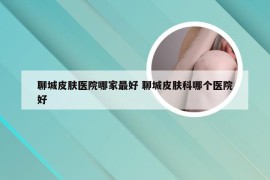 聊城皮肤医院哪家最好 聊城皮肤科哪个医院好