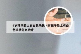 4岁孩子脸上有白色块状 4岁孩子脸上有白色块状怎么治疗