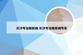 长沙专治银屑病 长沙专治银屑病专家