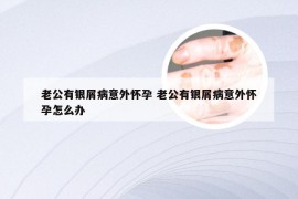老公有银屑病意外怀孕 老公有银屑病意外怀孕怎么办