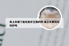 身上长癣了能吃鱼虾之类的吗 身上长癣可以吃虾吗