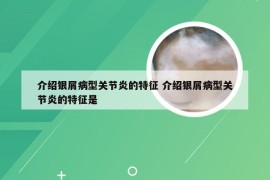 介绍银屑病型关节炎的特征 介绍银屑病型关节炎的特征是