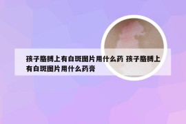 孩子胳膊上有白斑图片用什么药 孩子胳膊上有白斑图片用什么药膏