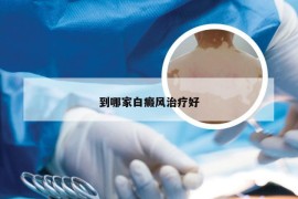 到哪家白癜风治疗好