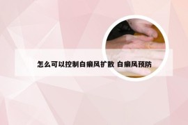 怎么可以控制白癞风扩散 白癞风预防