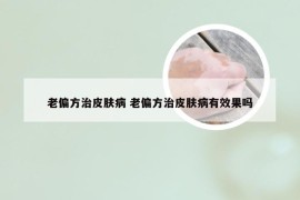 老偏方治皮肤病 老偏方治皮肤病有效果吗