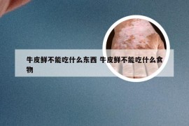 牛皮鲜不能吃什么东西 牛皮鲜不能吃什么食物