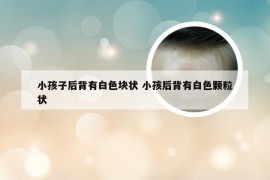 小孩子后背有白色块状 小孩后背有白色颗粒状
