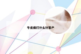 牛皮癣打什么针答户