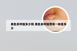 黑色素种植多少钱 黑色素种植费用一般是多少