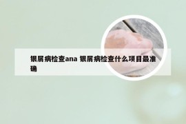 银屑病检查ana 银屑病检查什么项目最准确