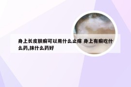 身上长皮肤癣可以用什么止痒 身上有癣吃什么药,抹什么药好