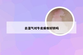 去湿气对牛皮癣有好转吗