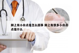 脚上有小白点是怎么回事 脚上有很多小白点点是什么