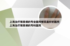 上海治疗银屑病的专业医院哪家最好的医院 上海治疗银屑病的专科医院