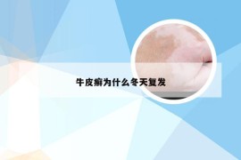 牛皮癣为什么冬天复发