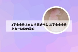 3岁宝宝脸上有白块是缺什么 三岁宝宝宝脸上有一块块的发白