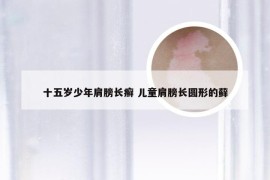 十五岁少年肩膀长癣 儿童肩膀长圆形的藓