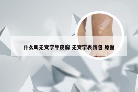 什么叫无文字牛皮癣 无文字表情包 原图