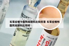 石家庄哪个医院皮肤科比较厉害 石家庄哪所医院皮肤科比较好