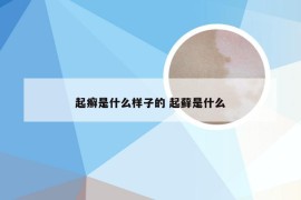 起癣是什么样子的 起藓是什么