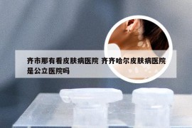 齐市那有看皮肤病医院 齐齐哈尔皮肤病医院是公立医院吗