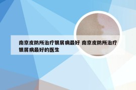 南京皮防所治疗银屑病最好 南京皮防所治疗银屑病最好的医生