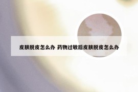 皮肤脱皮怎么办 药物过敏后皮肤脱皮怎么办
