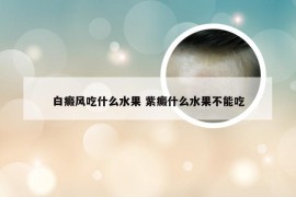 白癜风吃什么水果 紫癜什么水果不能吃