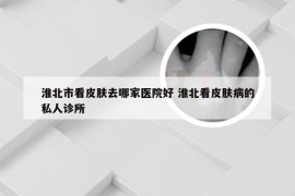 淮北市看皮肤去哪家医院好 淮北看皮肤病的私人诊所