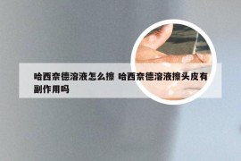 哈西奈德溶液怎么擦 哈西奈德溶液擦头皮有副作用吗