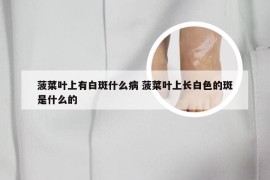 菠菜叶上有白斑什么病 菠菜叶上长白色的斑是什么的