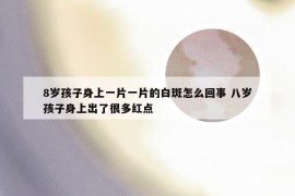 8岁孩子身上一片一片的白斑怎么回事 八岁孩子身上出了很多红点