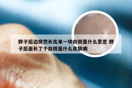 脖子后边突然长出来一块白斑是什么意思 脖子后面长了个白斑是什么皮肤病