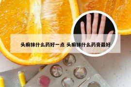 头癣抹什么药好一点 头癣抹什么药膏最好