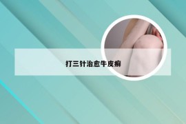 打三针治愈牛皮癣