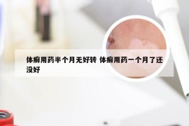 体癣用药半个月无好转 体癣用药一个月了还没好