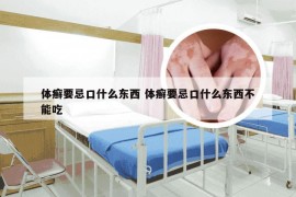 体癣要忌口什么东西 体癣要忌口什么东西不能吃