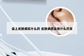 染上皮肤病买什么药 皮肤病感染用什么药膏