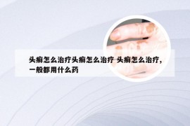 头癣怎么治疗头癣怎么治疗 头癣怎么治疗,一般都用什么药