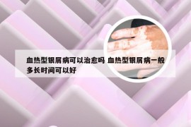 血热型银屑病可以治愈吗 血热型银屑病一般多长时间可以好