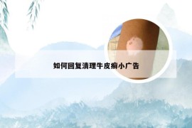 如何回复清理牛皮癣小广告