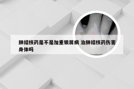 肺结核药是不是加重银屑病 治肺结核药伤害身体吗