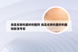 南昌皮肤科最好的医院 南昌皮肤科最好的医院脱发专家