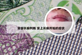 背部长癣判断 背上长癣开始的症状