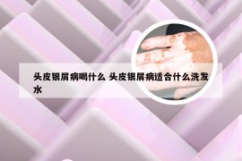 头皮银屑病喝什么 头皮银屑病适合什么洗发水