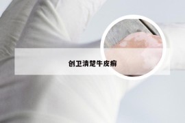 创卫清楚牛皮癣