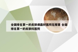 全国排名第一的皮肤病最好医院在那里 全国排名第一的皮肤科医院