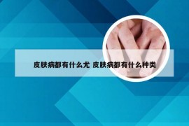 皮肤病都有什么尤 皮肤病都有什么种类