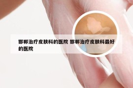 邯郸治疗皮肤科的医院 邯郸治疗皮肤科最好的医院